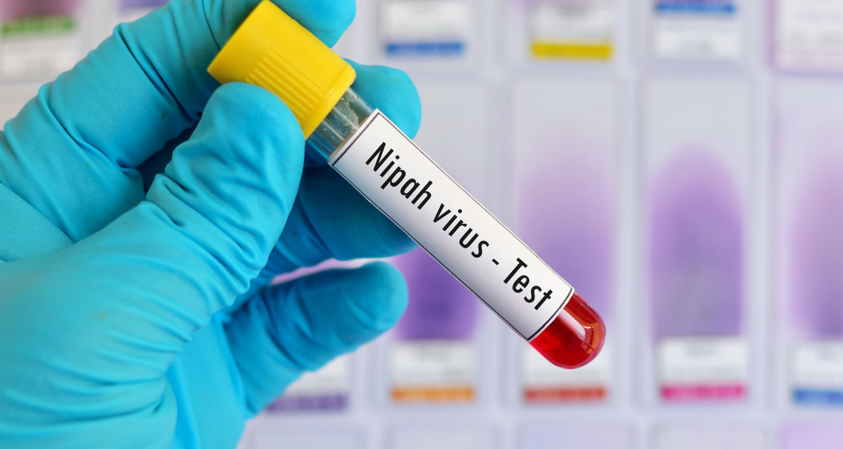 Virus Nipah Kembali Muncul, Ancaman Mematikan Tanpa Vaksin Hantui Asia