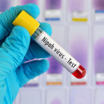Virus Nipah Kembali Muncul, Ancaman Mematikan Tanpa Vaksin Hantui Asia