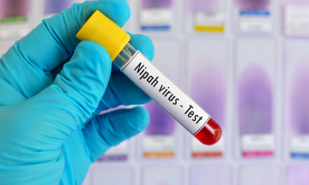 Virus Nipah Kembali Muncul, Ancaman Mematikan Tanpa Vaksin Hantui Asia