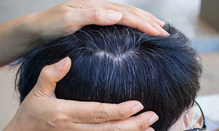 Usia 40-an, Rambut Tiba-Tiba Rontok? Ini 7 Cara Ampuh Mengatasinya!