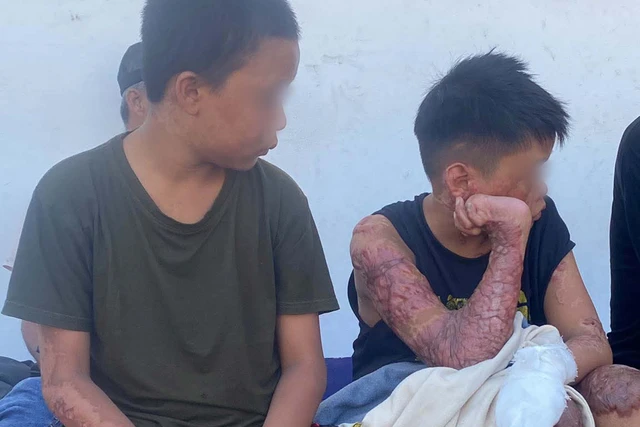 Komisi III DPR Kawal Kasus Dugaan Pembakaran Tiga Santri di Lombok Tengah
